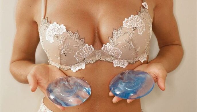 girl holding implants for breast augmentation