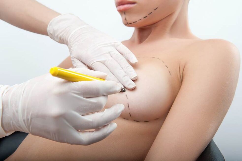 Operating methods