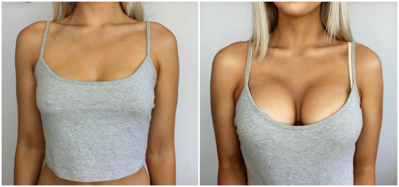 Operation before and after
